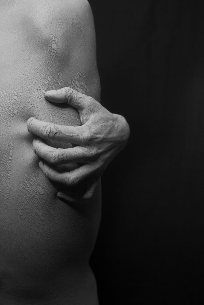 Detailed monochrome image of a hand holding dry skin, highlighting texture and tension.